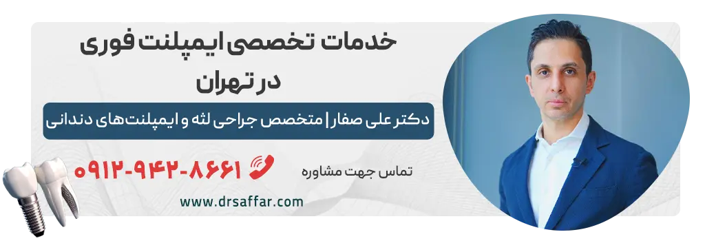 ایمپلنت فوری در تهران