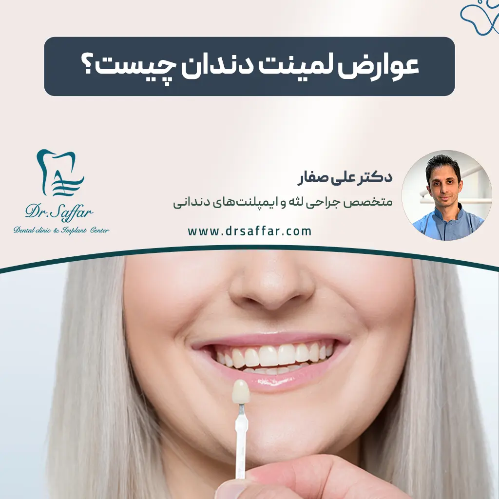 عوارض لمینت دندان