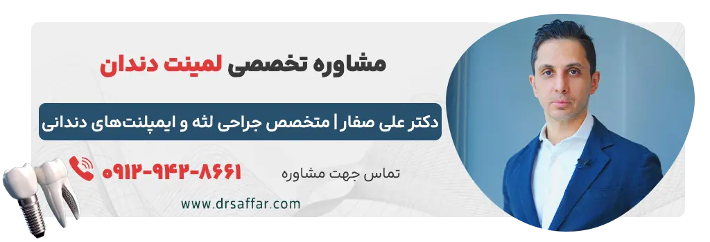مشاوره تخصصی لمینت دندان دکتر صفار