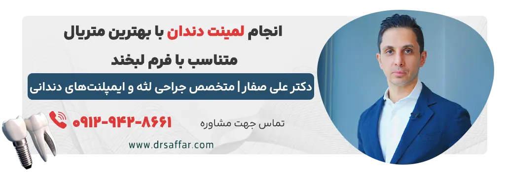 خدمات لمینت دندان با بهترین متریال، دکتر صفار