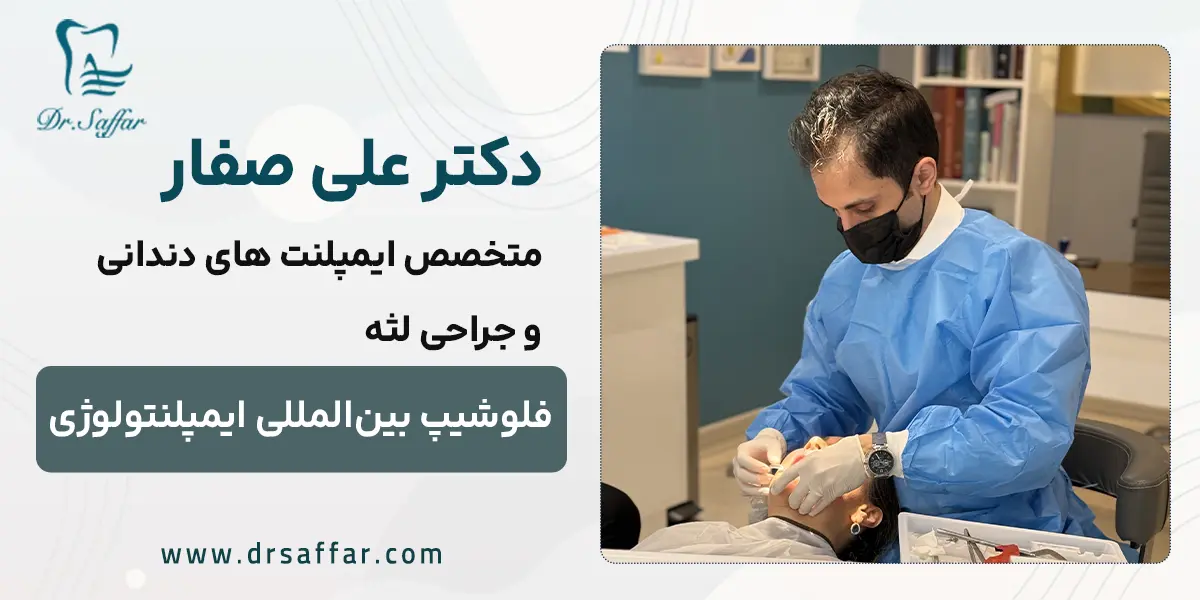 دکتر صفار بهترین دکتر ایمپلنت تهران