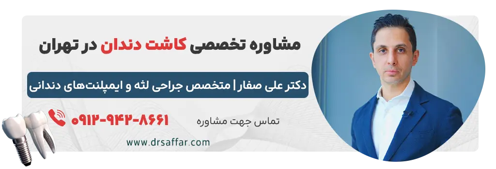 دکتر صفار، بهترین دکتر ایمپلنت در تهران