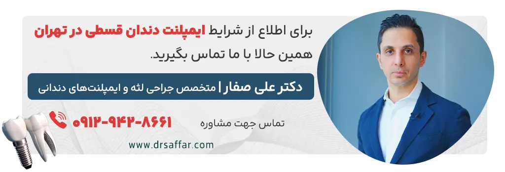 ایمپلنت دندان قسطی در تهران