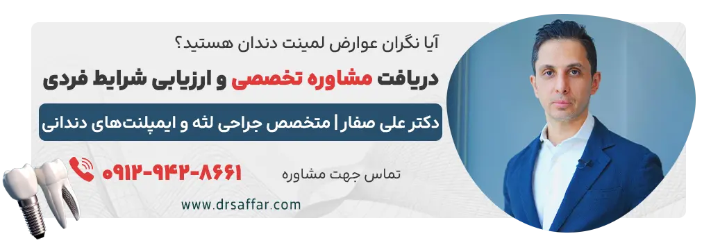 عوارض لمینت دندان