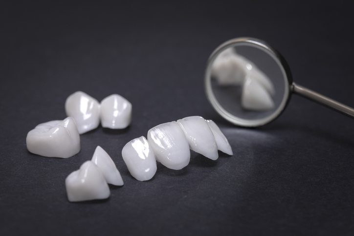 لمینت سرامیکی دندان چیست؟ انواع و مزایا لمینت سرامیکی