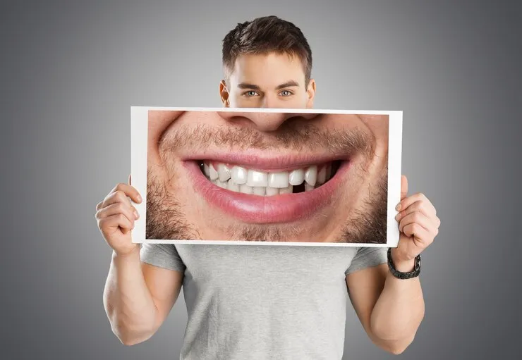 اصلاح طرح لبخند چیست